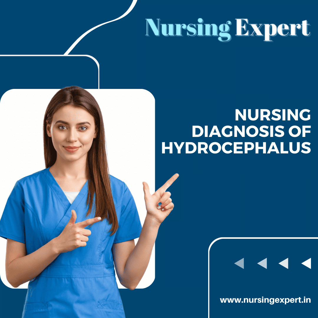 Nursing Diagnosis of Hydrocephalus